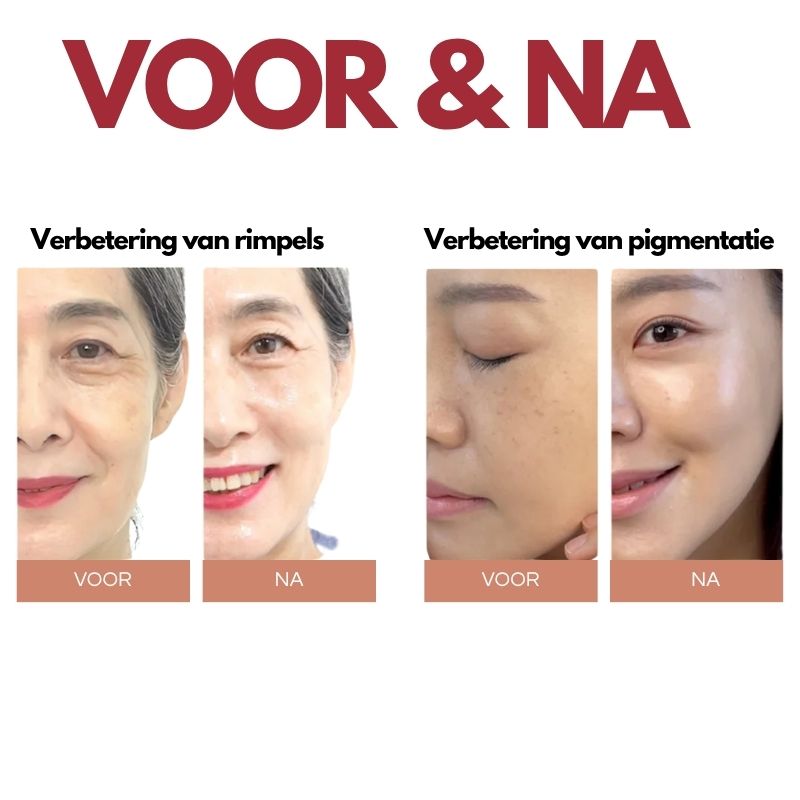 Seoul 1988 Serum™ –Vervaagt vlekken, onthult een egale huid