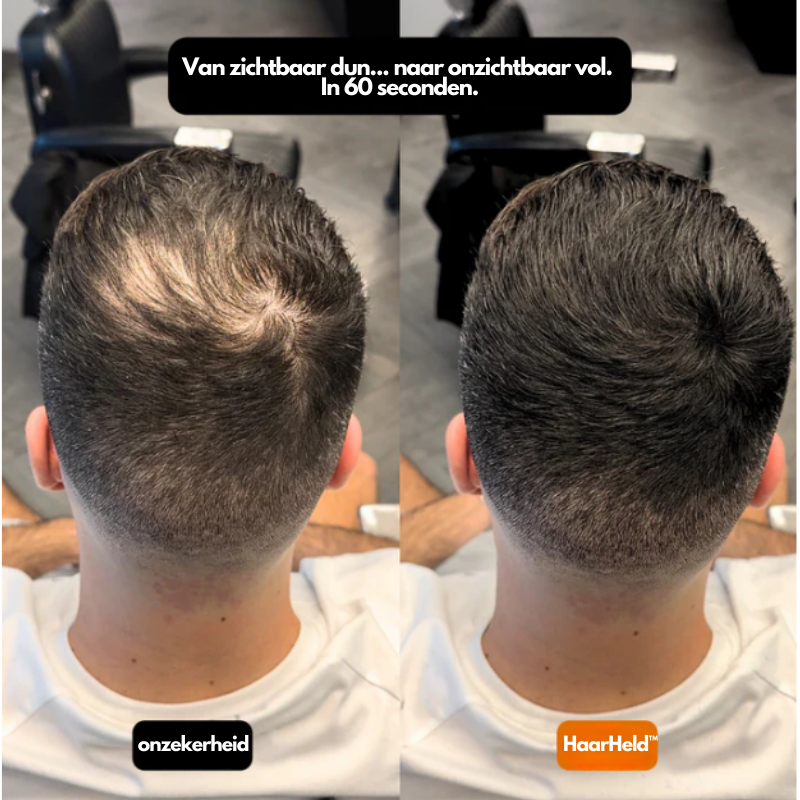 HaarHeld™ – Voor mannen die niet kiezen voor kaal, maar voor controle.