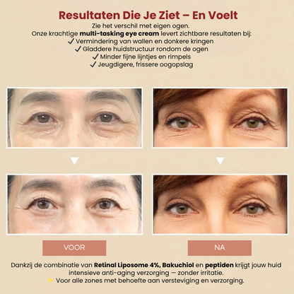 1988 Seoul GlowUp™ – Oogcrème voor Wallen, Lijntjes & Donkere Kringen