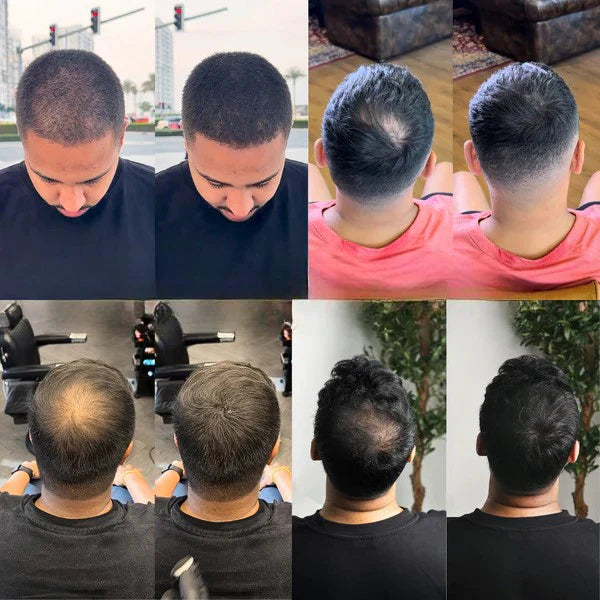 HaarHeld™ – Voor mannen die niet kiezen voor kaal, maar voor controle.