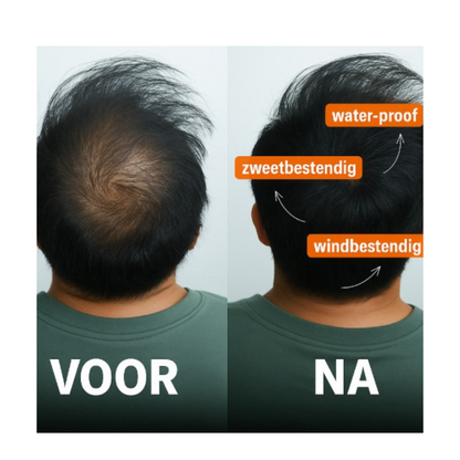 HaarHeld™ – Voor mannen die niet kiezen voor kaal, maar voor controle.