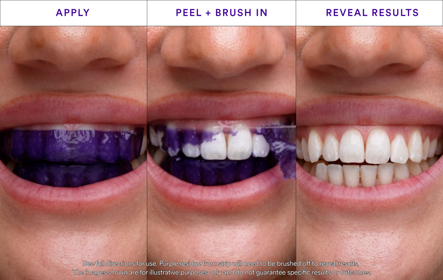 SmileBright™ Violet Strips – Direct zichtbaar wittere tanden, zonder peroxide!