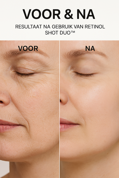Celimax Retinol Shot Duo™ -  Krachtig én Zacht voor Je Huid